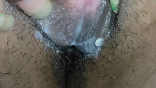 My X Wife Hot Pussy and Fingering in pussy indian vegina Discharge Vegina