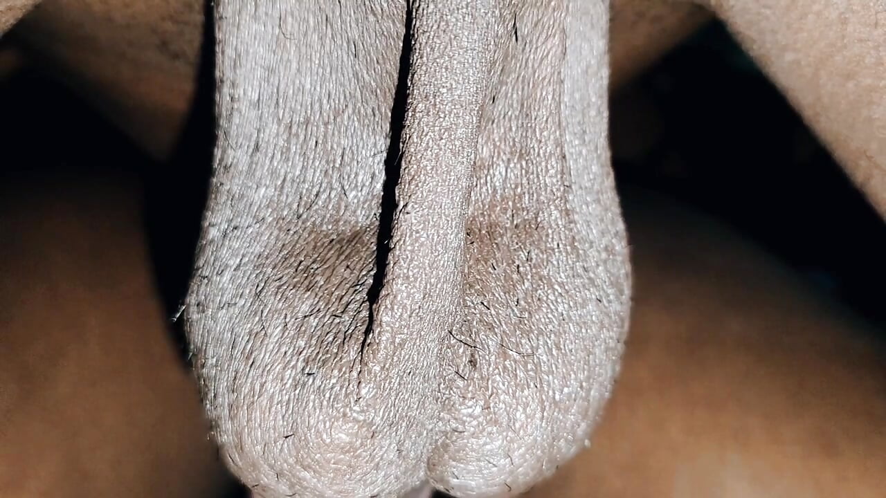 Sister-in-law’s chant left with finger